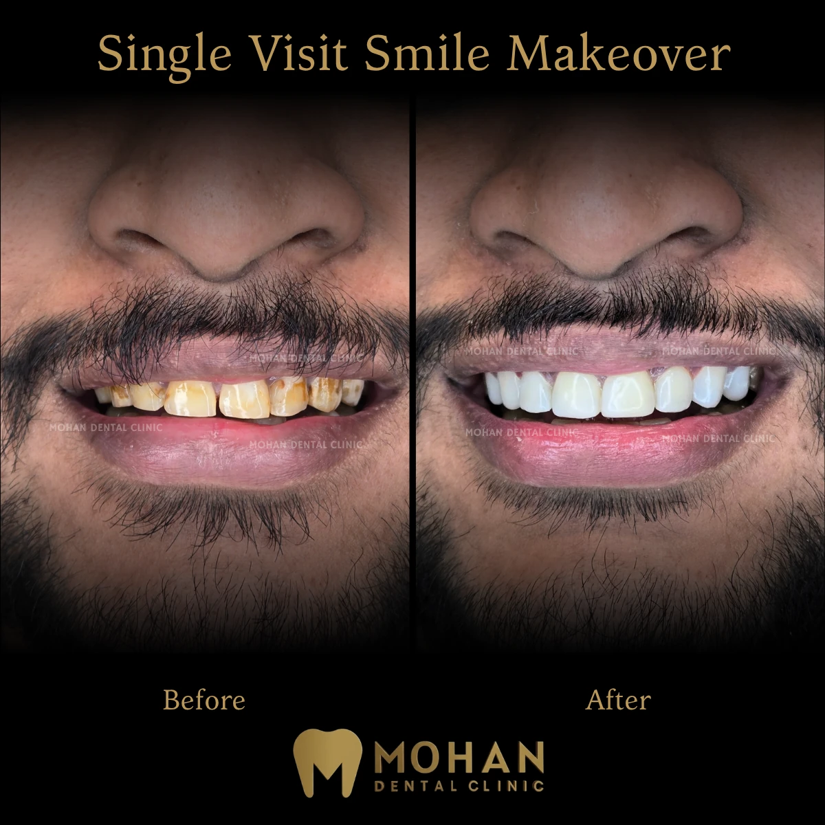 Heavy Stains Removed