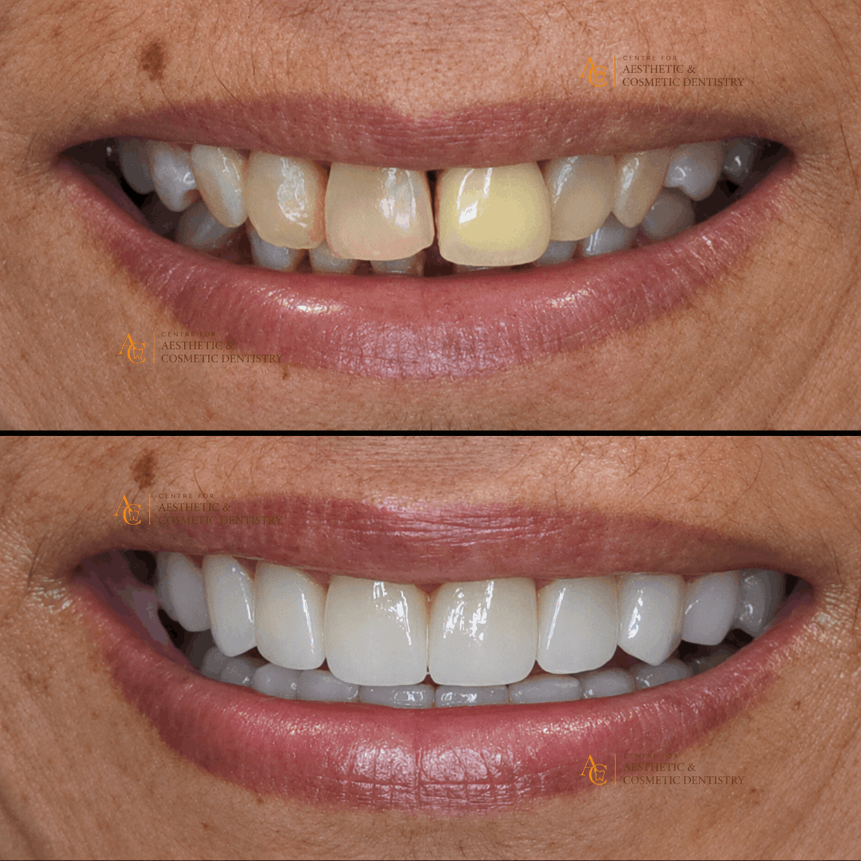 4 (1)