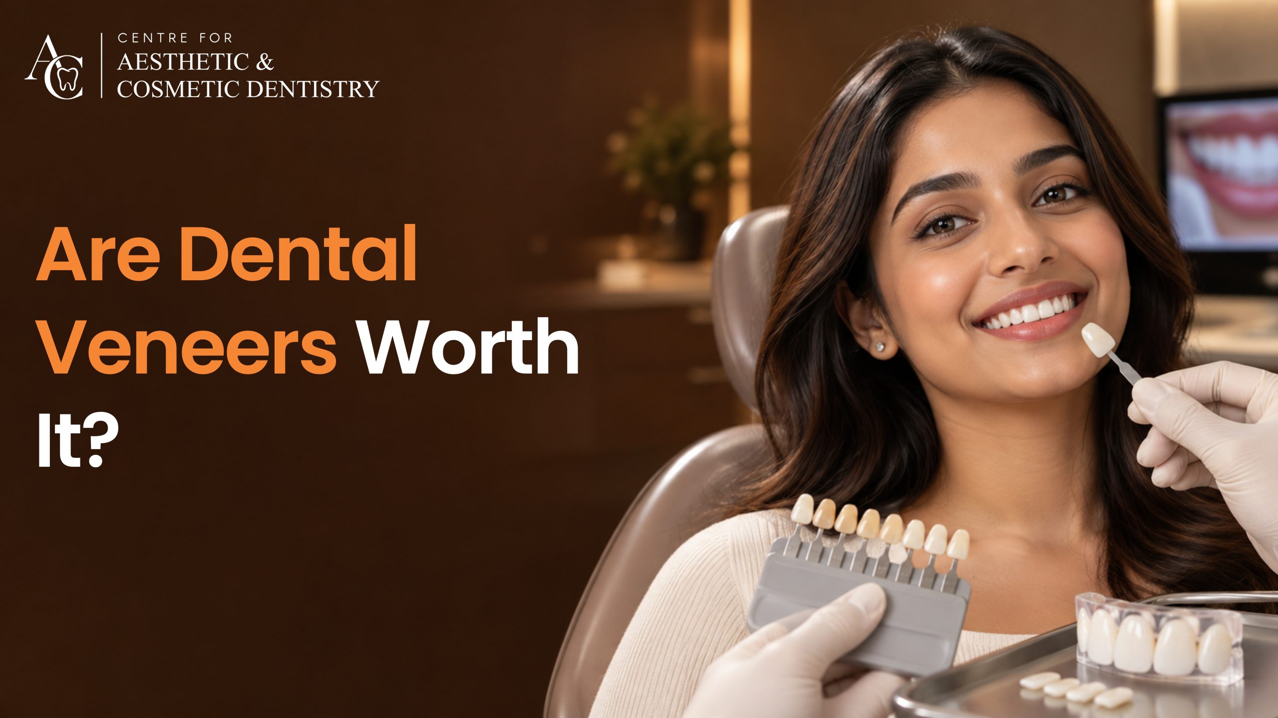 Are Dental Veneers Worth It? What Hyderabad Patients Should Know Before Treatment