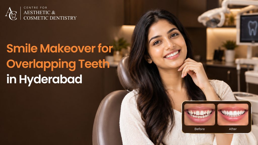 Smile Makeover for Overlapping and Discoloured Teeth in Hyderabad