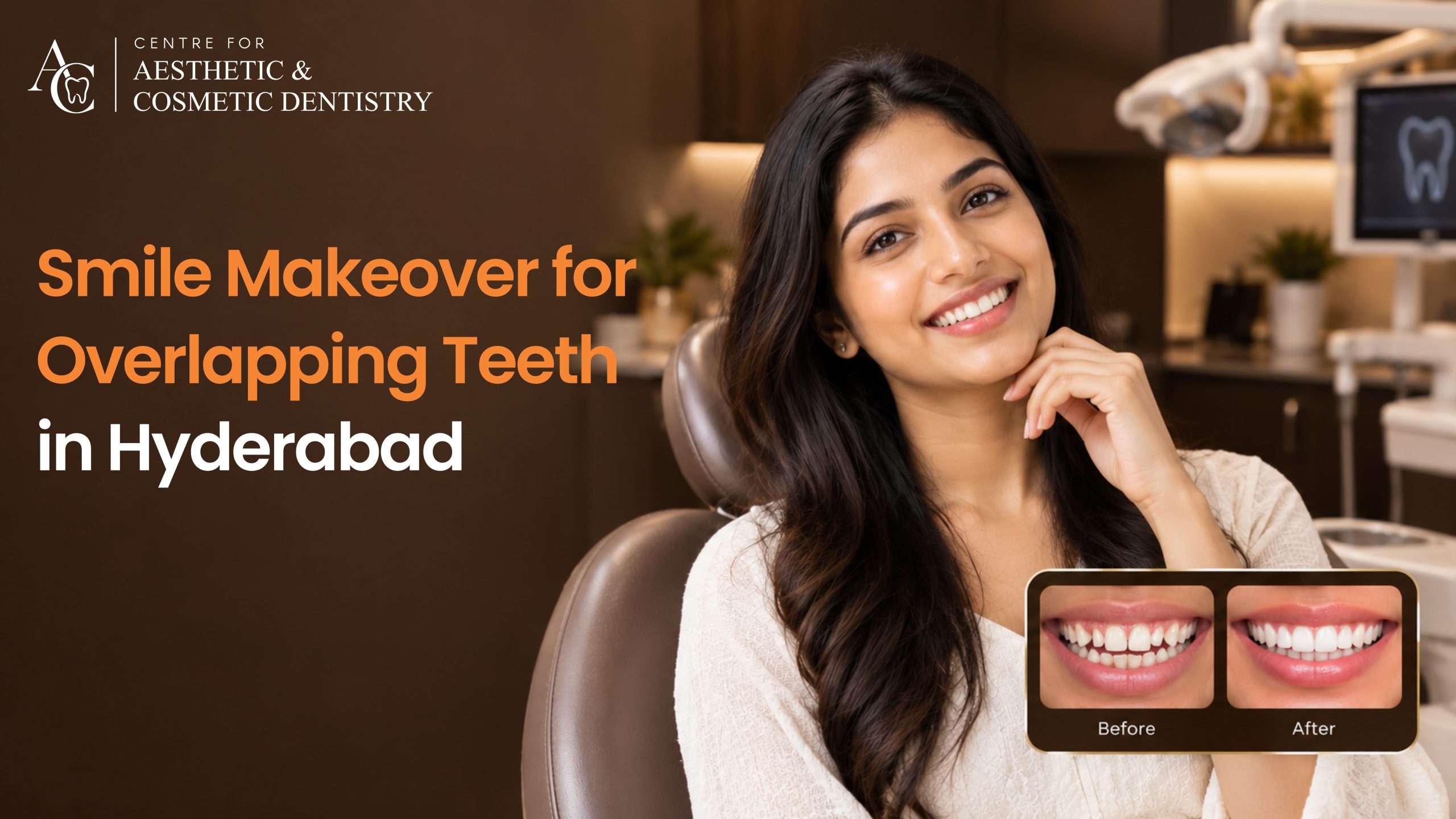 Smile Makeover for Overlapping and Discoloured Teeth in Hyderabad