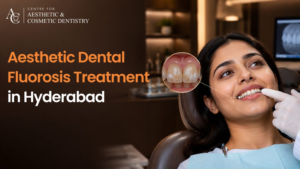 Aesthetic Dental Fluorosis Treatment in Hyderabad: Modern Smile Solutions