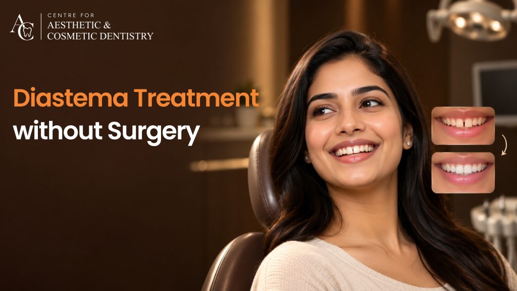 Diastema Treatment Without Surgery: Best Ways to Close Teeth Gaps