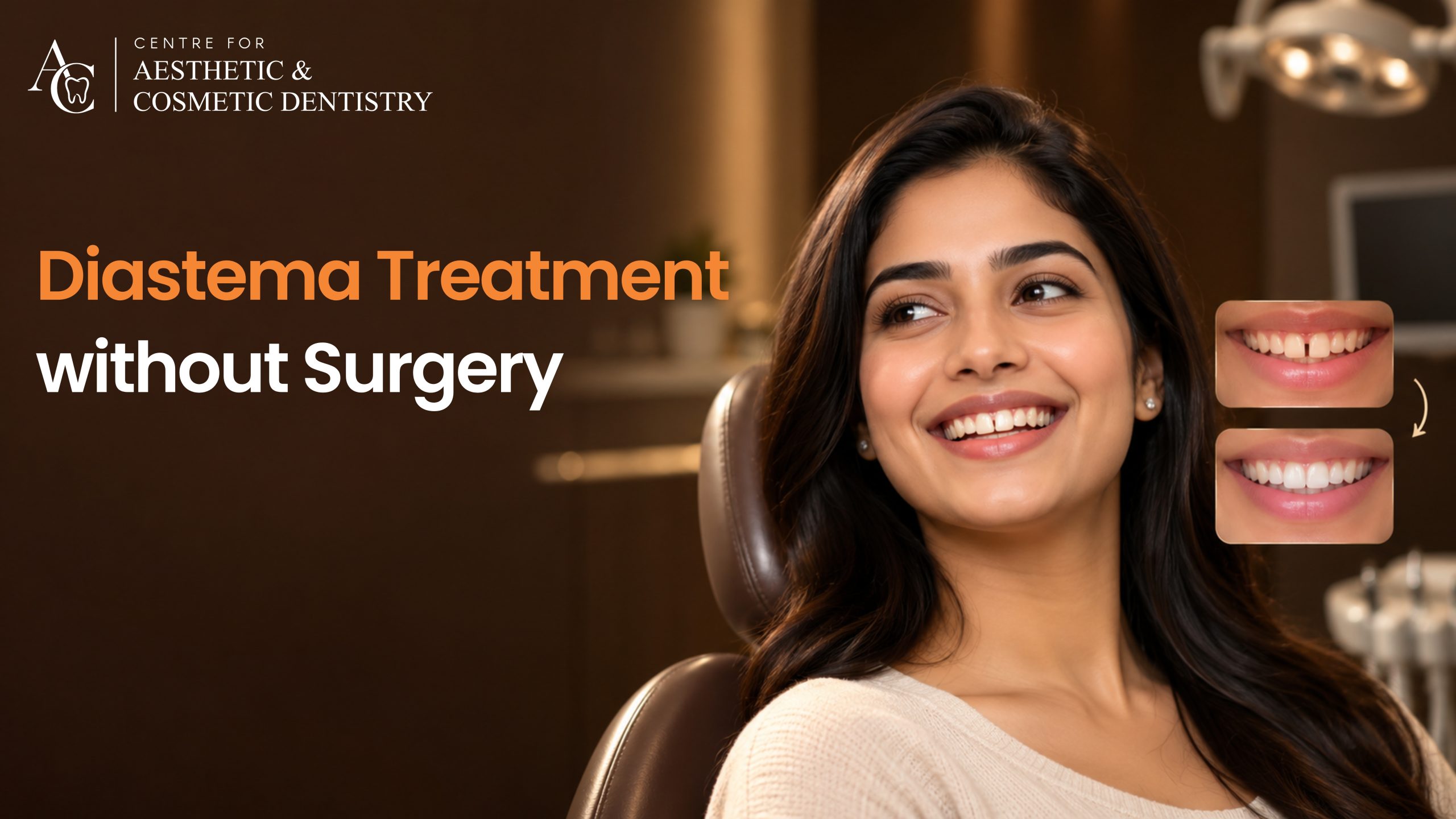 Diastema Treatment Without Surgery: Best Ways to Close Teeth Gaps