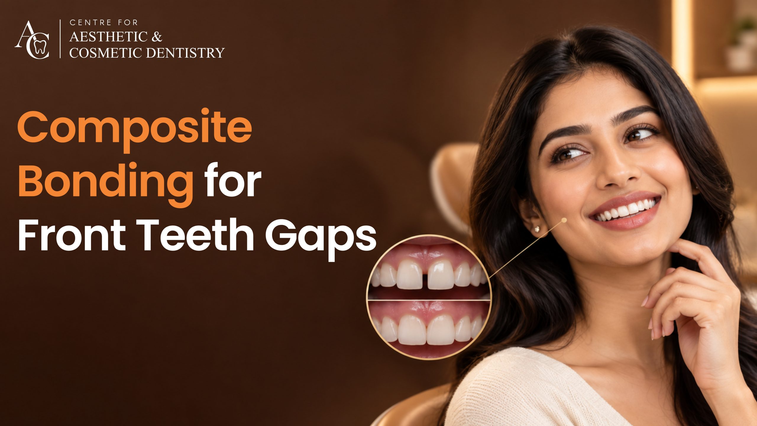 Can Composite Bonding Close a Wide Gap Between Front Teeth in One Visit?